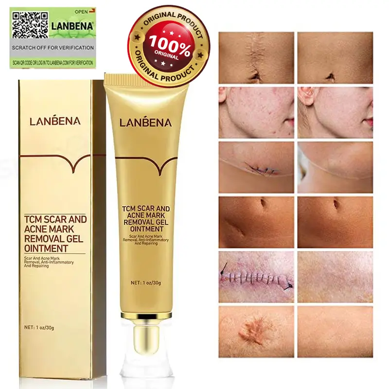 New LANBENA TCM Scar, Acne and Stretch Marks Removal Cream 1 lanbena tcm,tcm scar and acne mark removal gel ointment,tcm scar and acne removal gel,tcm cream,lanbena scar removal review,tcm scar and acne mark removal gel,tcm scar removal gel,lanbena scar removal cream,tcm scar removal,lanbena acne scar removal cream,lanbena scar remover,tcm scar cream,tcm scar and acne mark,lanbena tcm scar and acne mark removal,tcm scar,tcm acne scar removal cream,tcm gel,lanbena tcm scar and acne mark removal gel ointment,tcm scar and acne mark removal,lanbena acne scar removal,scar and acne mark removal gel,tcm acne scar cream,lanbena scar removal stretch marks serum review,lanbena tcm gel ointment,tcm scar and acne removal gel ointment,lanbena scar removal cream review,tcm scar and acne removal gel fake,tcm scar removal cream,lanbena scar removal stretch marks cream review,tcm scar and acne removal,tcm scar and acne removal gel review,scar and acne mark removal gel ointment,lanbena scar cream,tcm scar and acne removal gel price,tcm scar and acne removal gel original,tcm scar removal in mercury drug,tcm scar and acne,tcm lanbena,tcm scar and acne marks removal gel,lan be na scar cream,tcm scar and acne mark removal gel ointment price,lanbena tcm scar and acne removal gel,tcm scar and acne mark removal gel ointment review,tcm scar and acne marks removal gel review,tcm scar and acne removal gel before and after,lanbena scar,lanbena acne scar removal serum review,lanbena scar and acne mark removal gel,lanbena ointment,manfaat lanbena tcm scar and acne mark removal gel ointment,tcm acne and scar removal gel,tcm scar and acne mark removal gel ointment original,tcm acne scar removal cream price,tcm acne scar removal,lanbena scar removal ingredients,tcm cream review,tcm scar gel,tcm cream price,tcm scar and acne removal cream,lanbena scar remover review,lanbena scar removal serum review,lanbena acne scar mark removal gel ointment,lanbena scar removal price,lanbena tcm scar,lanbena scar removal gel,tcm scar and acne removal gel ingredients,lanbena tcm scar removal gel,lanbena tcm scar and acne mark removal gel ointment ingredients,aliver tcm scar cream review,lanbena tcm scar and acne mark removal review,cara pakai tcm scar and acne mark removal gel ointment,tcm gel ointment,aliver tcm scar and acne mark removal gel ointment,tcm scar and acne removal ointment,lanbena scar removal gel review,manfaat tcm scar and acne mark removal gel ointment,tcm scar and acne mark removal gel review,tcm scar removal price,lanbena tcm review,lanbena tcm scar removal,tcm scar and acne mark removal gel ointment lanbena,original tcm scar cream,lanbena tcm scar and acne mark removal gel,tcm scar removal fake and original,lanbena tcm scar and acne mark removal gel ointment review,kegunaan tcm scar and acne mark removal gel ointment,tcm lanbena scar removal,lanbena tcm cream,lanbena acne scar,lanbena acne scar removal cream review,lanbena acne scar removal review,lanbena acne scar removal cream price,tcm scar and acne mark removal gel ointment prix,lanbena scar removal stretch marks serum watson,aliver tcm scar and acne removal gel,tcm scar and acne marks removal gel ointment,tcm scar and,lanbena gel ointment,tcm scar and acne mark removal ointment,lanbena tcm scar and acne mark removal gel review,lanbena acne gel review,lanbena tcm original,tcm scar and acne mark removal gel price,lanbena scar removal original,lanbena tcm website,lanbena scar and acne removal gel,tcm scar and acne mark removal gel ointment avis,lanbena tcm watson,tcm scar and acne removal gel lanbena,tcm scar acne mark removal gel,tcm scar removal gel ingredients,acne scar removal cream lanbena,tcm scar removal review,lanbena scar and acne mark removal gel ointment,lan be na scar gel,scar acne mark removing gel,lanbena tcm scar review,tcm gel review,tcm scar and acne mark removal review,harga tcm scar and acne mark removal gel ointment,aliver tcm scar removal gel,lanbena gel ointment review,tcm scar and mark removal gel ointment,tcm scar cream review,tcm acne mark removal gel,lanbena scar cream review,review lanbena scar,tcm lanbena scar eraser review,tcm acne scar removal gel,tcm scar removal cream review,tcm scar and acne mark removal gel ointment ingredients,scar & acne mark removal gel ointment,lanbena removal gel,tcm lanbena review,lanbena scar gel review,lanbena tcm gel ointment review,review lanbena tcm scar,tcm gel original,tcm scar removal gel ointment,lanbena tcm acne scar removal cream,lanbena tcm serum,tcm scar removal gel price,lanbena scar removal ointment,tcm scar gel review,review tcm scar and acne mark removal gel ointment,tcm acne scar,tcm removal gel,tcm scar and removal gel ointment,tcm acne and scar removal gel review,tcm scar and acne mark removal gel ointment deutsch,lan be na tcm scar and acne mark,lanbena scar serum review,tcm scar cream original,tcm acne mark removal gel ointment,lanbena acne scar remover,tcm lanbena cream,lanbena scar review,cara menggunakan tcm scar and acne mark removal gel ointment,fungsi tcm scar and acne mark removal gel ointment,lan be na cream,tcm acne scar cream review,tcm cream for scars,tcm lanbena original,lanbena tcm price,lanbena scar ointment,lanbena tcm scar remover,review lanbena acne scar,lanbena tcm stretch marks,tcm scar removal original